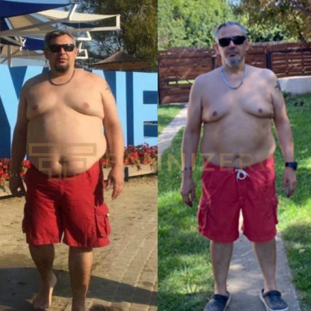 F. Dénes története